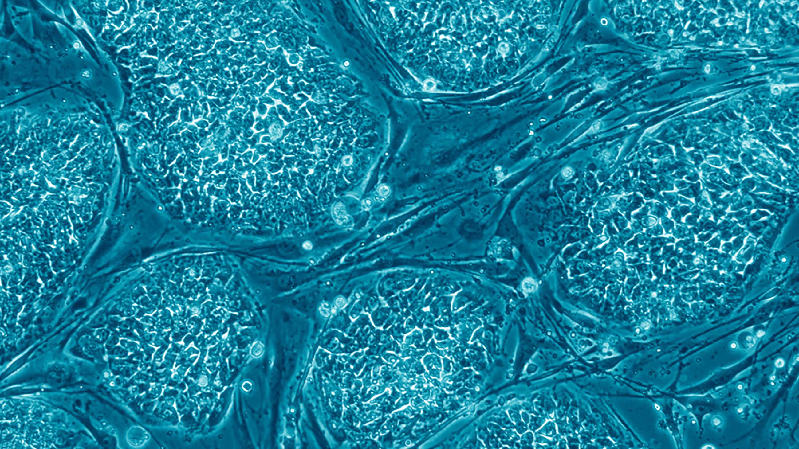 Stem Cell Therapy Human Stem Cells